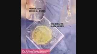 تفاوت انواع پروتز سینه