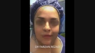 عمل های همزمان جوانسازی صورت کلینیک دندانپزشکی