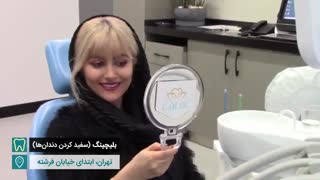 بلیچینگ دندان