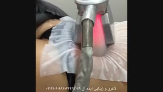 لاغری موضعی سریع با کرایولیپولیز