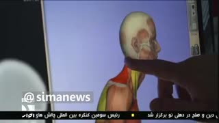 گردن پیامکی و آسیب‌های جدی به ستون فقرات