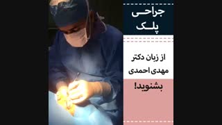 جراحی پلک در کلینیک توس