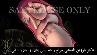 فیلم زایمان طبیعی واقعی