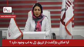 آیا امکان بازگشت از تزریق ژل به لب وجود دارد ؟ | کلینیک هلیا | 02122810089