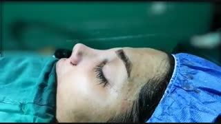 جراحی بینی گوشتی مدل نیمه فانتزی