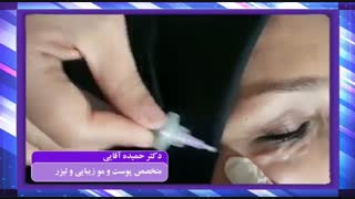 کربوکسی تراپی دور چشم تزریق چربی