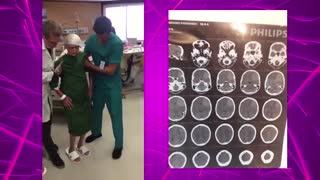 عمل جراحی تومور مغز خونریزی دهنده و بسیار بزرگ