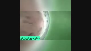 ویدیو مراحل انجام ivf