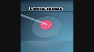 درمان نازایی با روش IVF