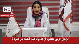 تزریق چربی معمولا از کدام ناحیه گرفته می شود ؟ | کلینیک هلیا | 02122810089
