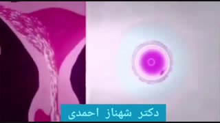 تفاوت بارداری طبیعی با IVF