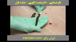 پارت 1 - آموزش زالو درمانی