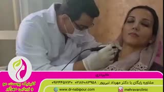 برداشتن خال