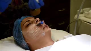 مراقبت از پوست با میکرودرم آر اف فرکشنال