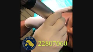 لیزر جوانسازی - 22807060