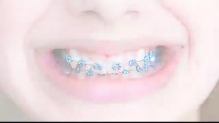 دکتر داودیان | متخصص ارتودنسی