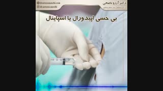 بی حسی اپیدورال