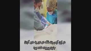 پیچیده شدن بند ناف دور گردن جنین در زایمان طبیعی