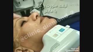 هایفو تراپی صورت - کلینیک زیبایی و لیزر دایموند قیطریه