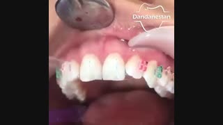 ارتودنسی | دندانستان