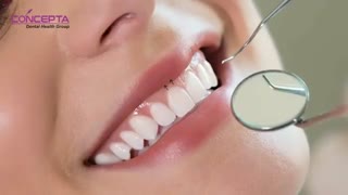 لبخند لثه ای (Gummy Smile) | دندانستان