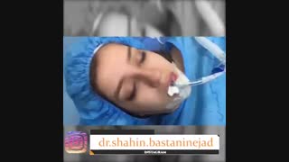 فیلم عمل زیبایی بینی