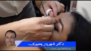 نحوه چسب زدن بینی | دکتر شهریار یحیوی