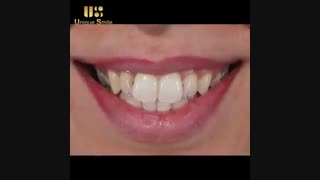 اصلاح شکل دندانها | دندانستان