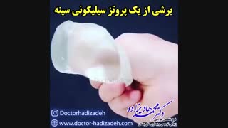 برشی از یک پروتز سیلیکونی سینه