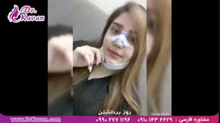 فیلم ارسالی از قبل تا یک ماه بعد از جراحی بینی توسط دکتر کاوان