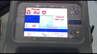 جراحی تومور خوش خیم حنجری با لیزر