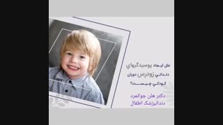 علل پوسیدگی دندان کودکان