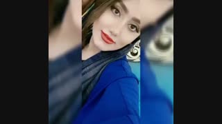 نمونه کار جراحی بینی آکنه