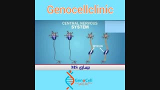 بیماری ام اس چیست؟