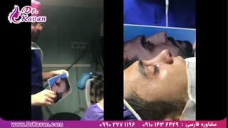 عمل بینی و رفع مشکل تنفسی