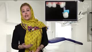 روکش ایمپلنت چیست؟