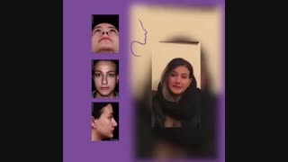 نمونه جراحی بینی