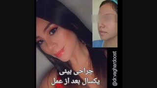 عمل زیبایی بینی