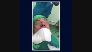 جراحی بینی مردانه