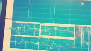 ناهنجاری های مادرزادی ستون فقرات