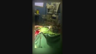 جراحی تشنج مقاوم به درمان