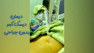 درمان دیسک کمر بدون جراحی