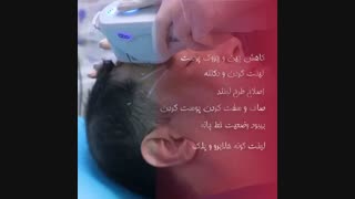 از بین بردن تمام چین و چروک های صورت فقط در یک ساعت