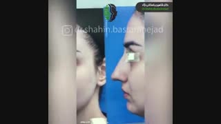 فیلم جراحی بینی نیمه فانتزی