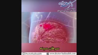 سرطان سینه