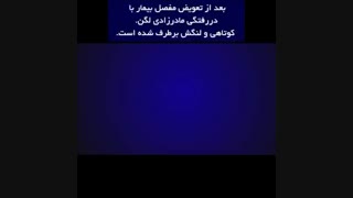 تعویض مفصل بیمار با دررفتگی مادرزادی لگن