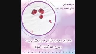 خونریزی بعد از نزدیکی