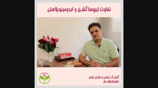 تفاوت لیپوساکشن و ابدومینوپلاستی