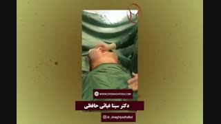 پروتز سینه به شکل توبورس یا بوقی شکل