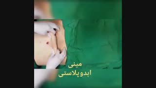 مینی ابدو - دکتر ابدالی - 22807060